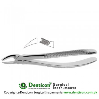 Cowhorn English Pattern Tooth Extracting Forcep Fig. 90 (For Upper Left Molars) Stainless Steel, Standard